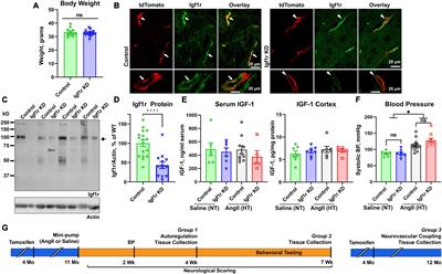 IGF1R deficiency in vascular smooth muscle cells impairs myogenic autoregulation and cognition in mice